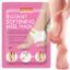 PUREDERM INSTANT SOFTENING HEEL MASK 18 GM