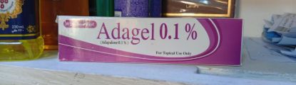 ADA GEL 0.1% 30GM TOPICAL GEL