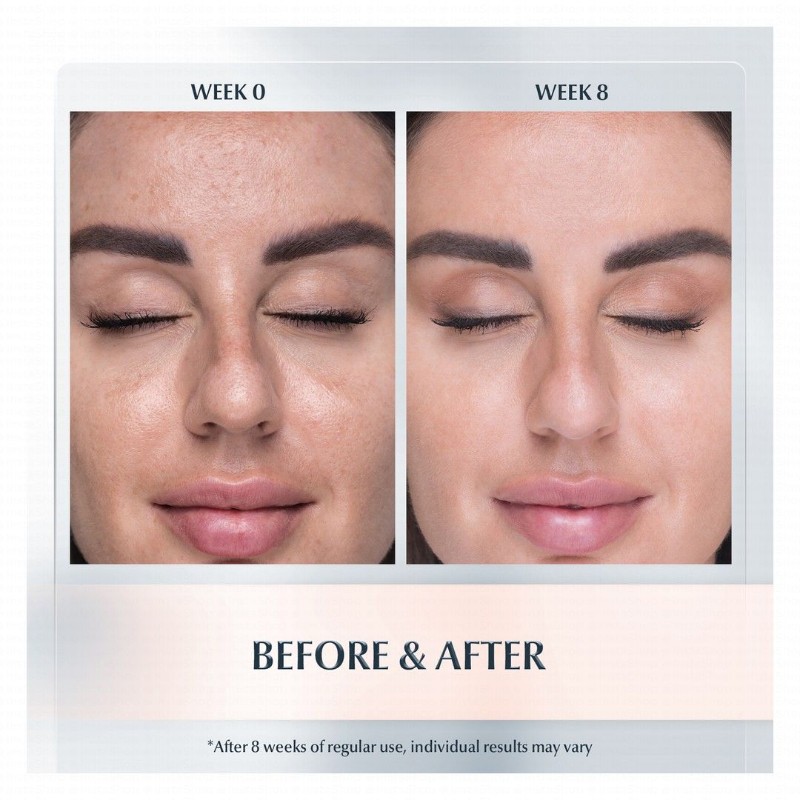 Eucerin Pigment Perfector Facial Day Cream for Uneven Skin Tone SPF30