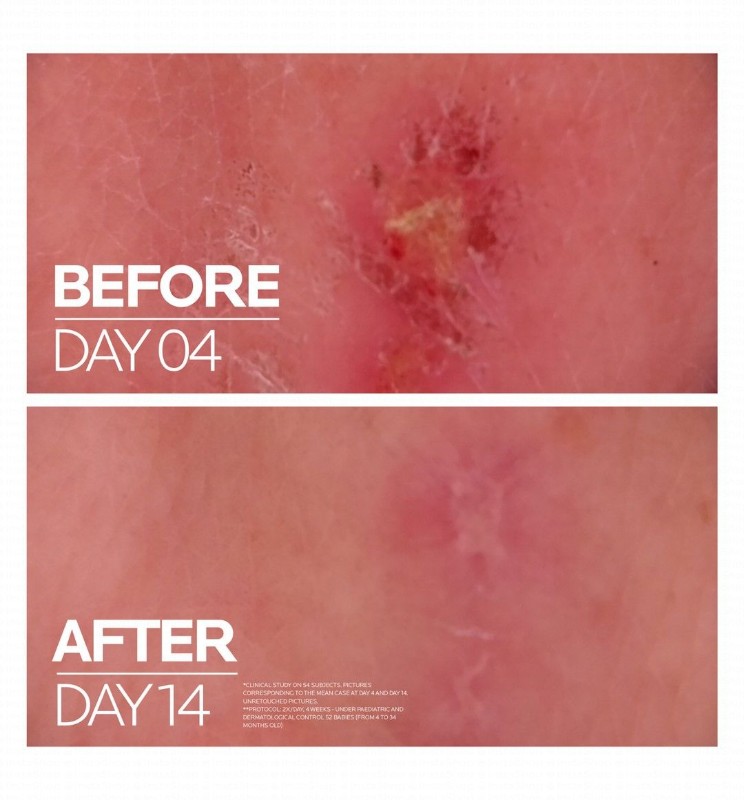 La Roche-Posay Cicaplast B5 Plus Ultra-Repairing & Soothing Balm with Panthenol, Madecassoside & Tribioma